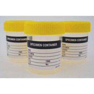 Specimen Containers - 10 pack